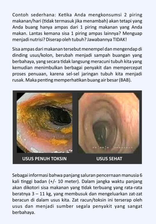 Perbandingan usus kotor beracun vs usus sehat