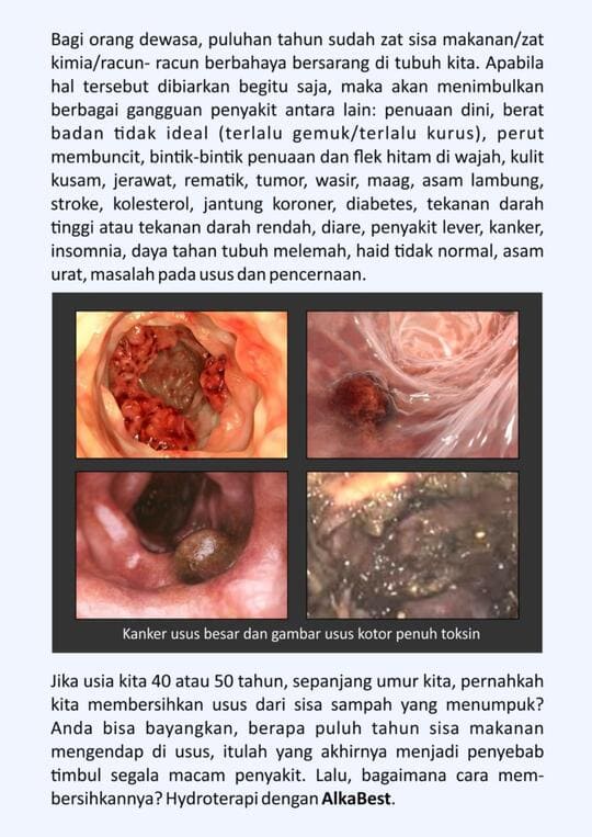 Pentingnya membersihkan usus dari racun dan toksin